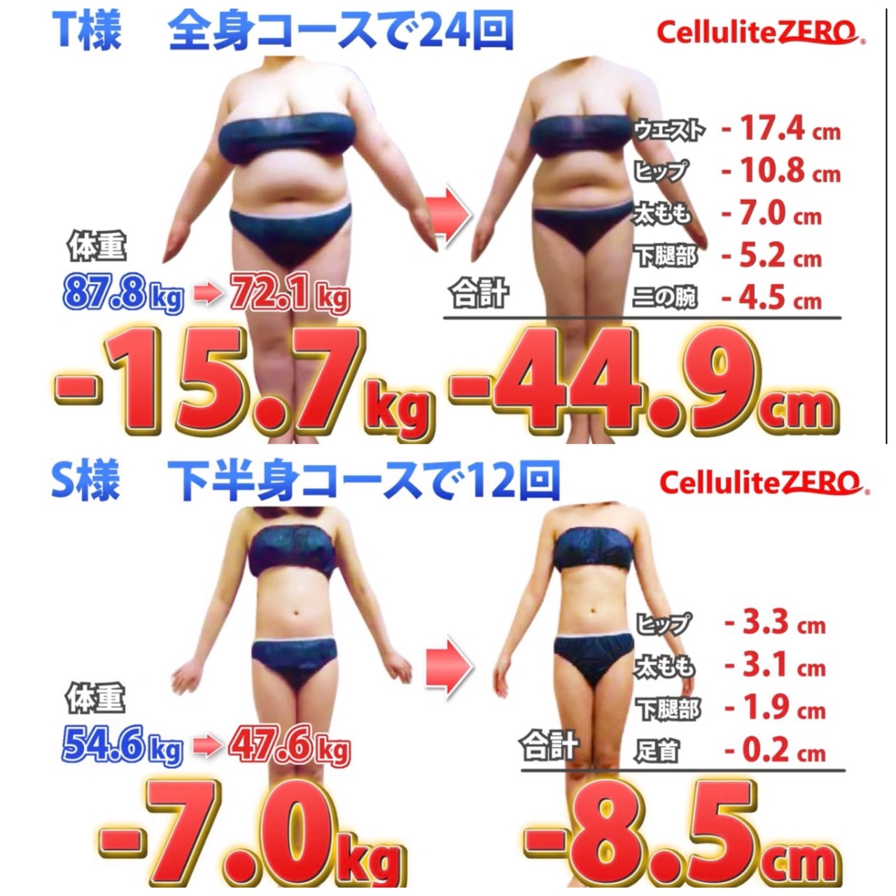 痩身 Before - After